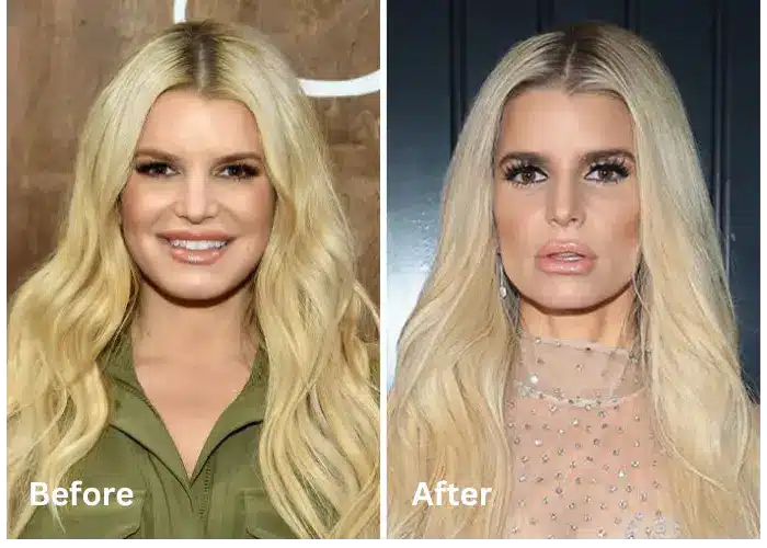 Jessica Simpson 