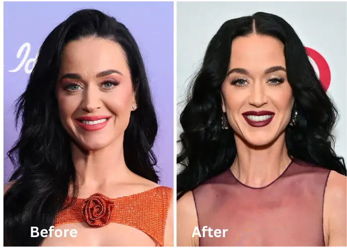 ozempic face celebrities