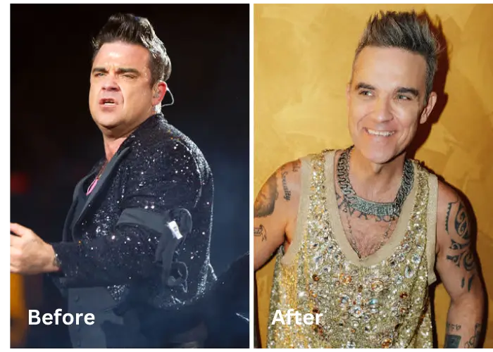 Robbie Williams