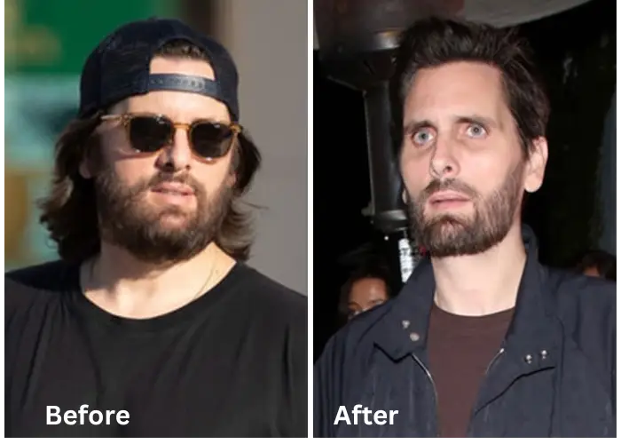 Scott Disick