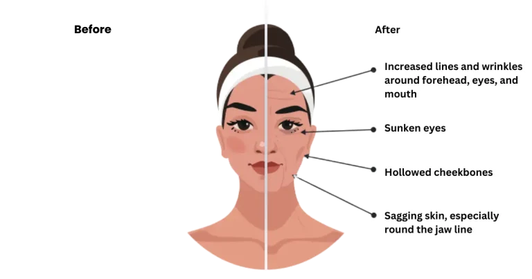 Ozempic face celebrities
Ozempic face before and after
Signs of Ozempic face
How to avoid Ozempic face
Ozempic face celebrities before and after
Ozempic butt
How to fix Ozempic face naturally
Pictures of Ozempic face wrinkles
