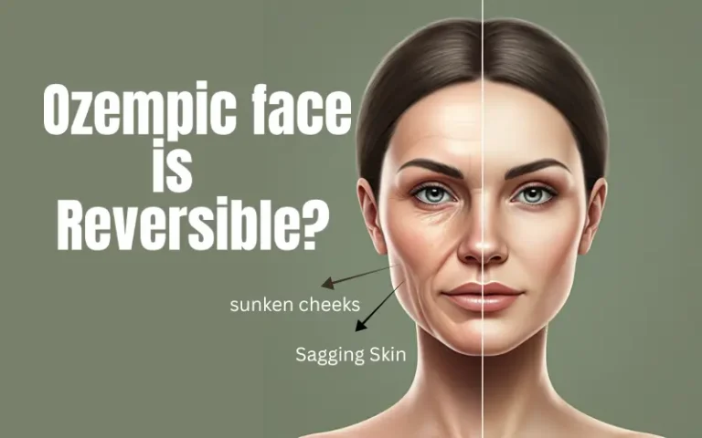 Ozempic face is reversible